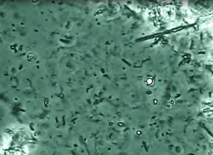 歯周内科治療とは？