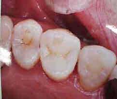 見た目に問題が出る